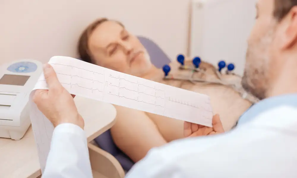 Arrhythmias and ECG abnormalities in COVID-19