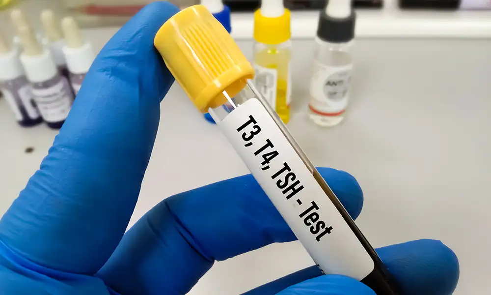 Common patterns of Secondary Dyslipidemias