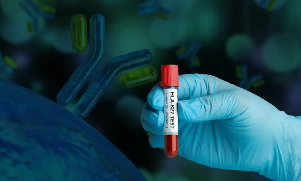 HLA B27 Detection: Flow Cytometry & PCR