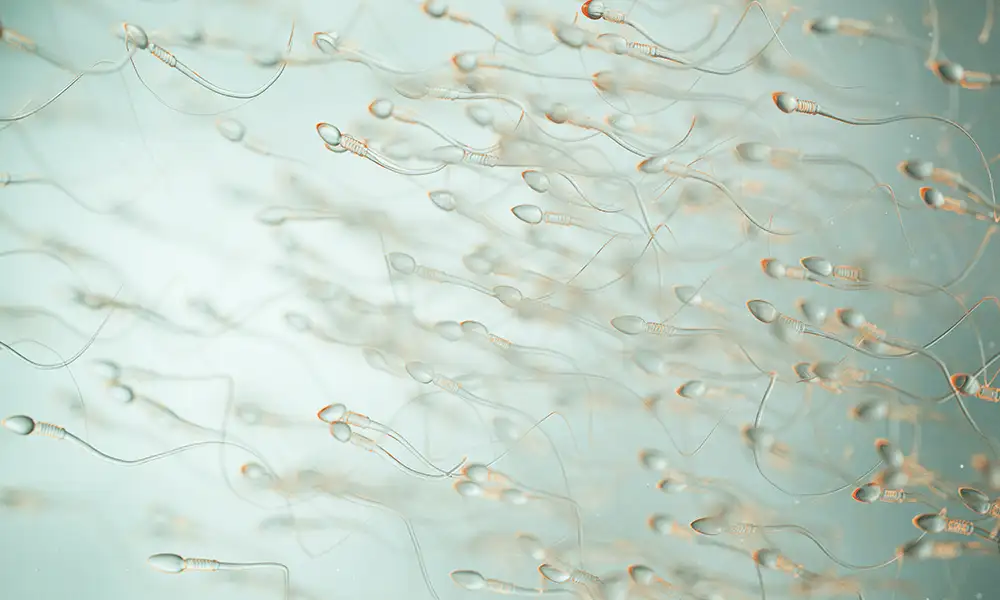 Semen Analysis Trends – A 6 Year Study