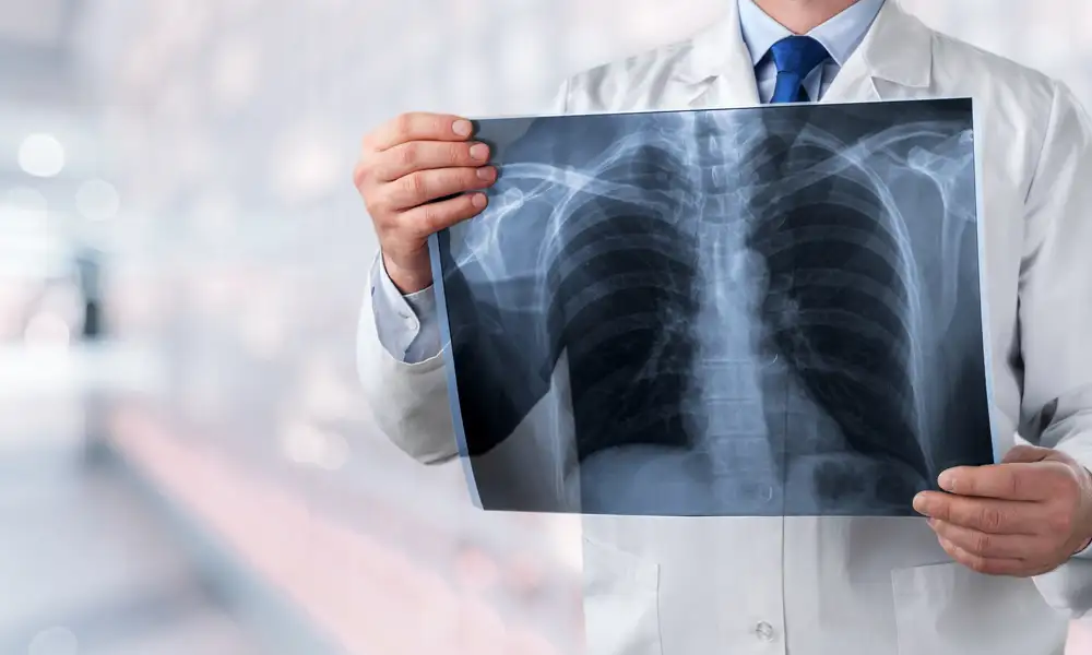 X-Ray: An Initial Screening Tool in the Diagnosis of Mucormycosis
