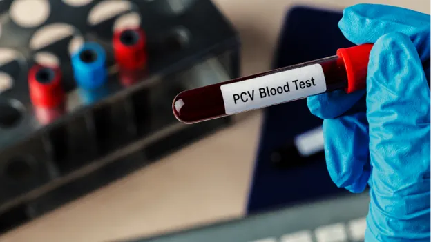 What is PCV in Blood Test? Purpose, Test Results, Normal Range and Much More