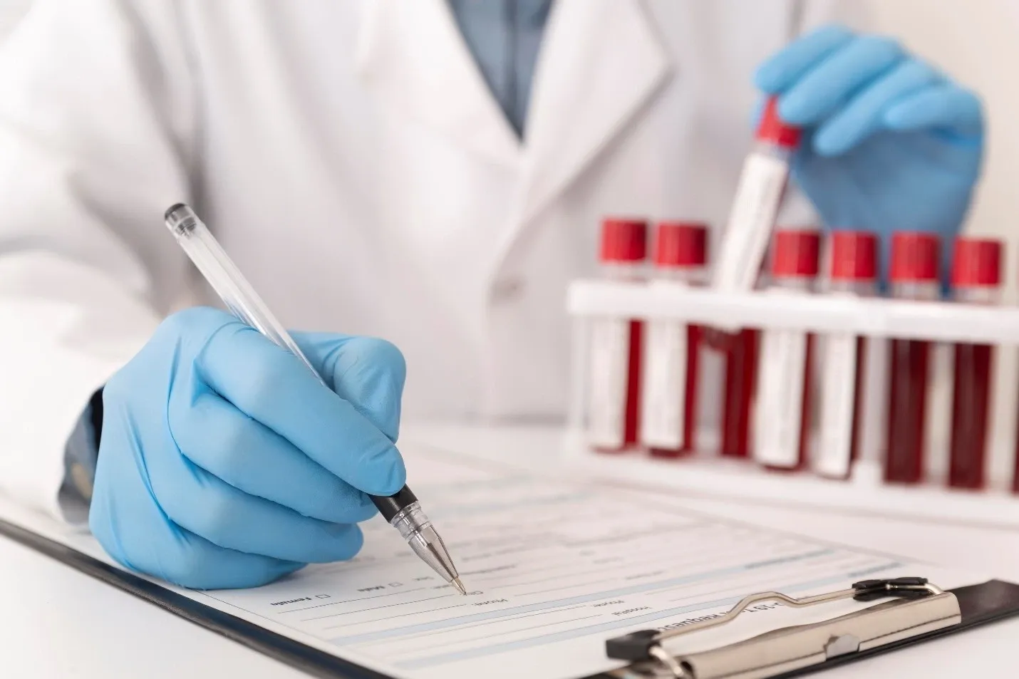 SGPT Test: Normal Range, Purpose, and Interpretation of Results