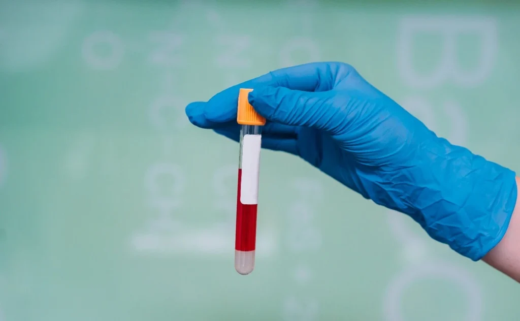 sogt test Purpose test results normal range